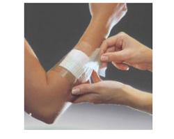 FILM ADESIVO IN POLIURETANO IN ROTOLO TRASPARENTE IMPERMEABILE PER FISSAGGIO DI MEDICAZIONI E CATETERI 10X1000CM 1 PEZZO - Doctor Vinz