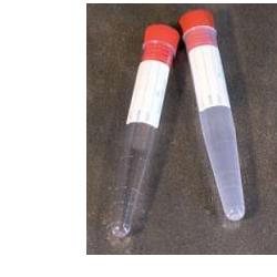 PROVETTA CONICA PER URINA 10ML - Doctor Vinz